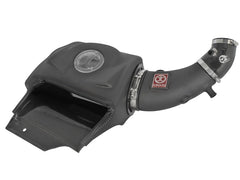aFe Système d'admission Takeda Stage 2 Pro Dry S 00-09 Honda S2000 L4 2.0/2.2L